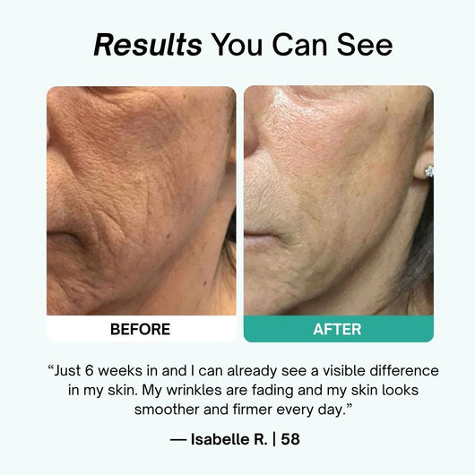 Rejuvera™ RenewMask
