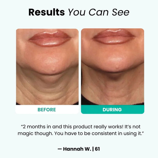 Rejuvera™ RenewMask